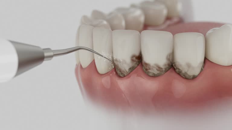 Reliable Dental contractor in Vandalia, MO by Smile Center Dentistry